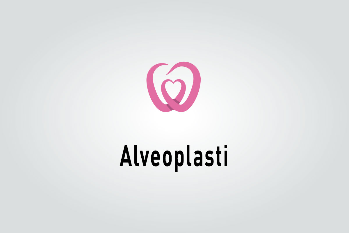 Alveoplasti